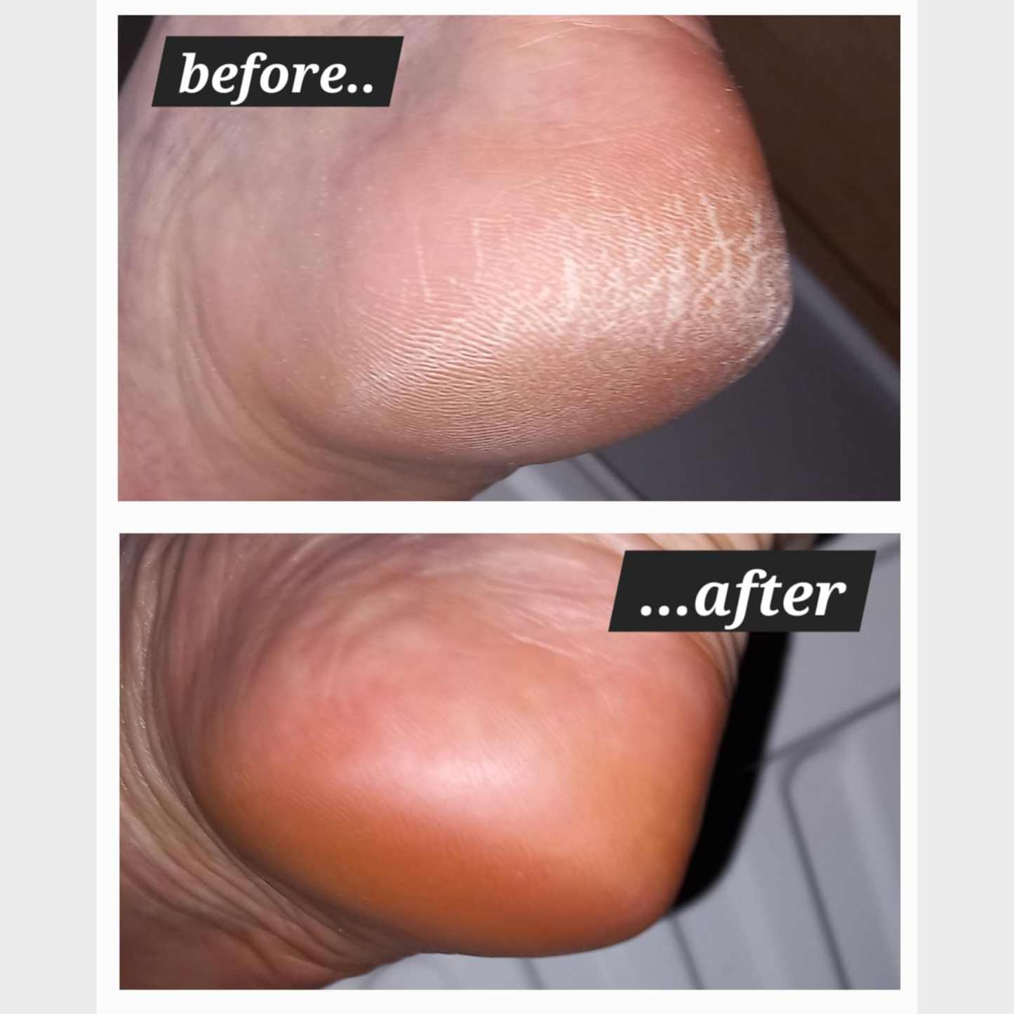 Sylvera Electric Foot Grinder