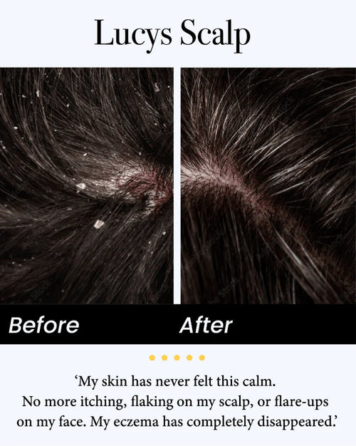 Sylvera Natural Calming Serum